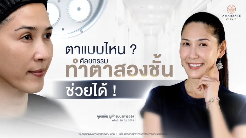 ตาแบบไหนศัลยกรรม ทำตาสองชั้น ช่วยได้!