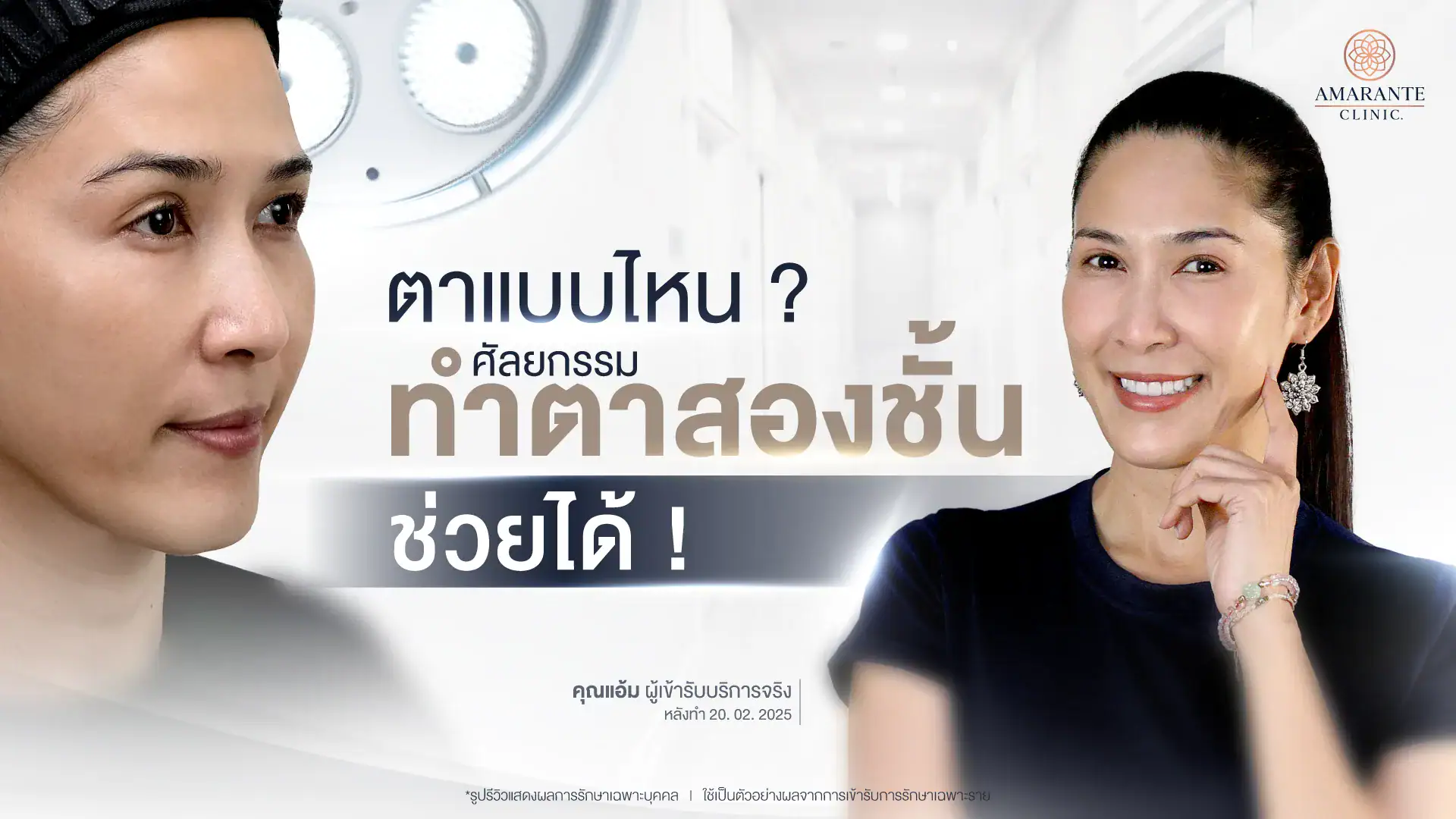ตาแบบไหนศัลยกรรม ทำตาสองชั้น ช่วยได้!