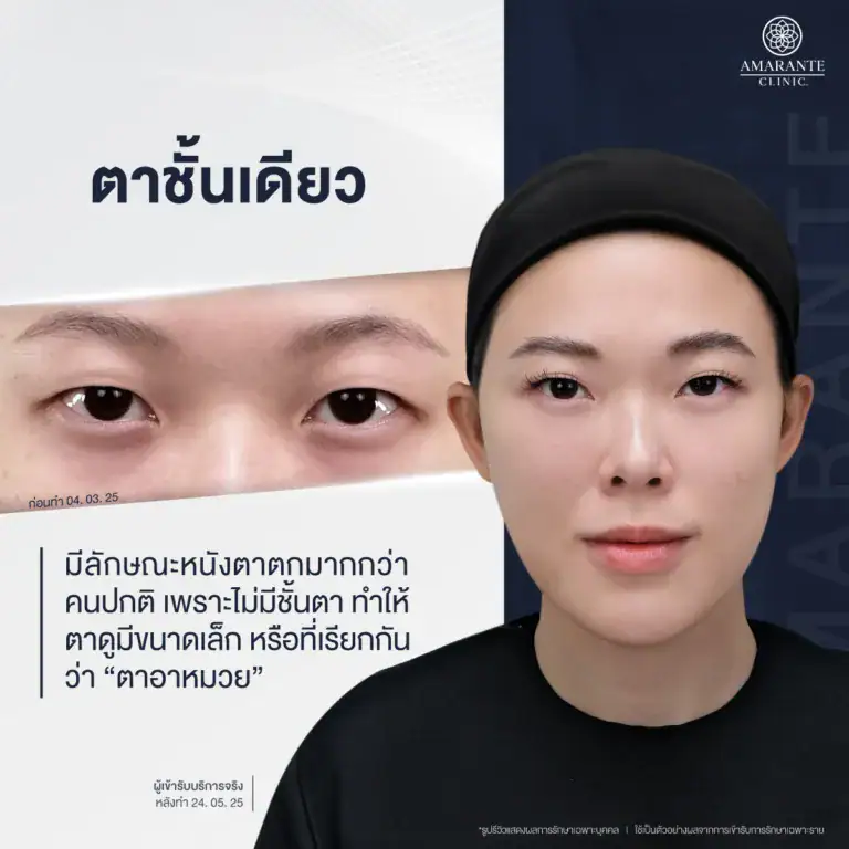 ตาชั้นเดียว