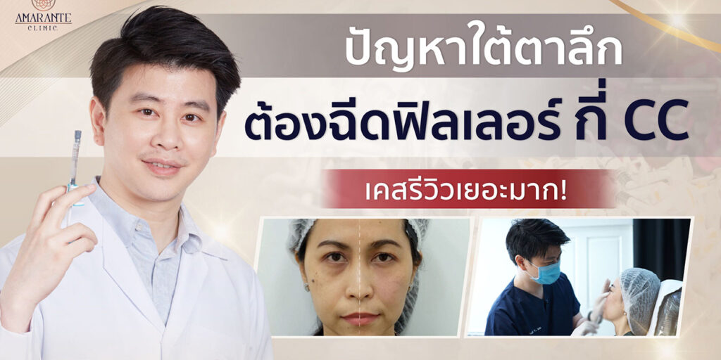 ปัญหาใต้ตาลึก ฉีดฟิลเลอร์ใต้ตา ใช้กี่ cc