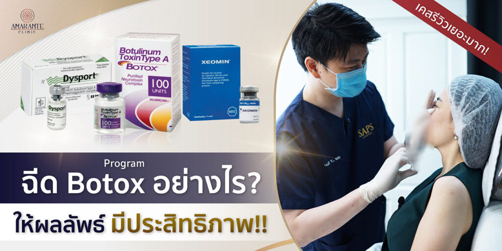 ฉีดโบท็อก ยังไงให้อยู่ได้นาน