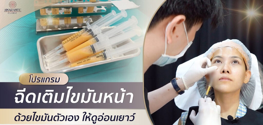ฉีดไขมันหน้า ด้วยไขมันตัวเอง ดูอ่อนเยาว์