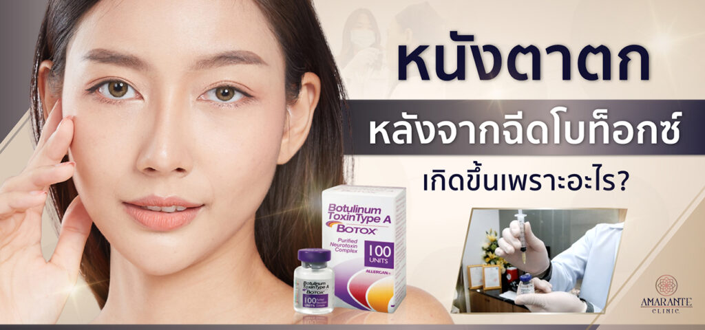 หนังตาตก หลังจากฉีดโบท็อกซ์ เกิดขึ้นได้อย่างไร