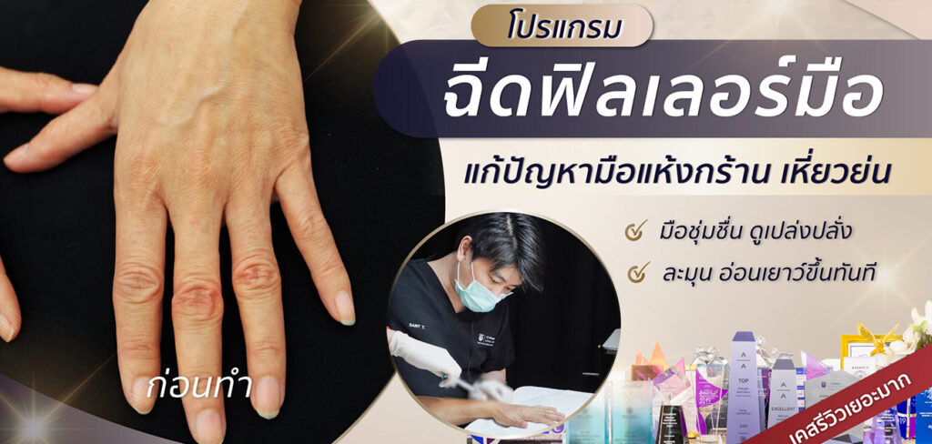 ฉีดฟิลเลอร์มือ แก้ปัญหามือแห้ง เหี่ยวย่น