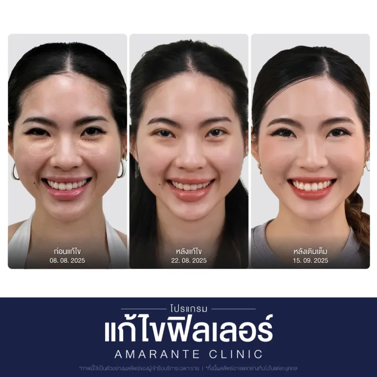 BA-คุณหมวย