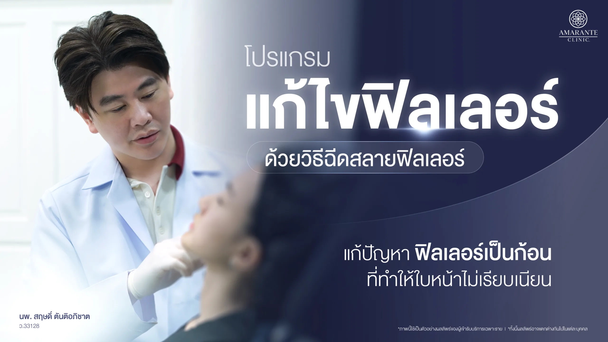 ฉีดสลายฟิลเลอร์ แก้ไขฟิลเลอร์ เป็นก้อน เป็นลำ ไม่เรียบเนียน