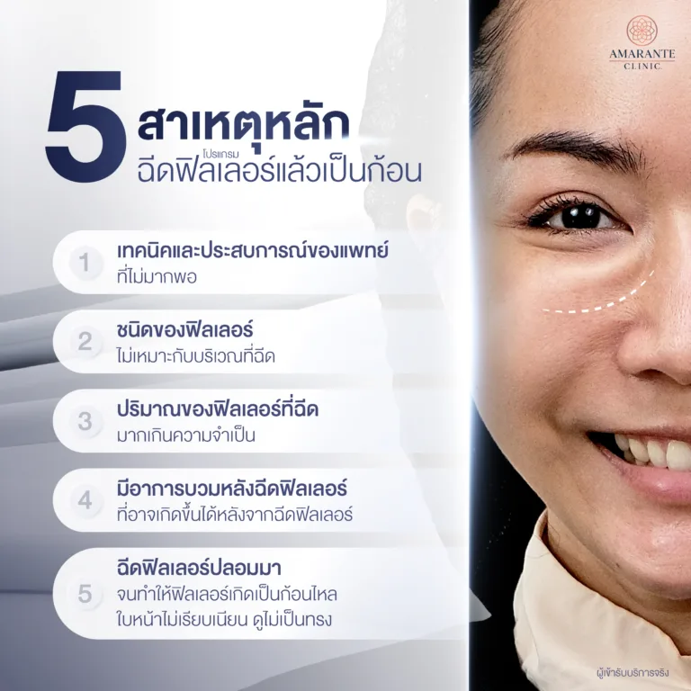 สาเหตุของการฉีดฟิลเลอร์เป็นก้อนไม่เรียบเนียน