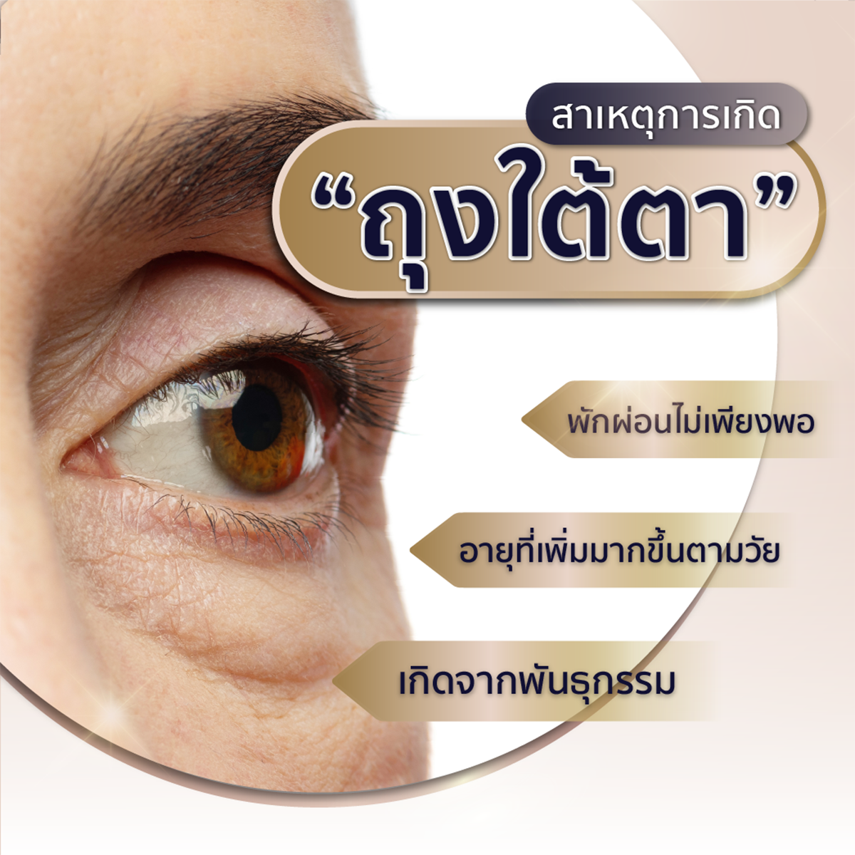 ศัลยกรรม ผ่าตัดถุงใต้ตา