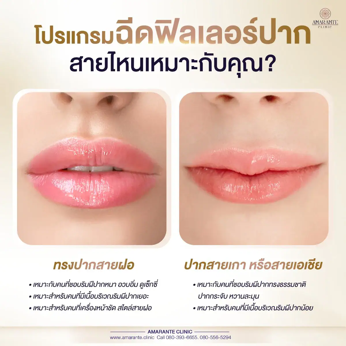 หลังฉีด ฟิลเลอร์ปาก , ปากสายฝอ , ปากสายเกา