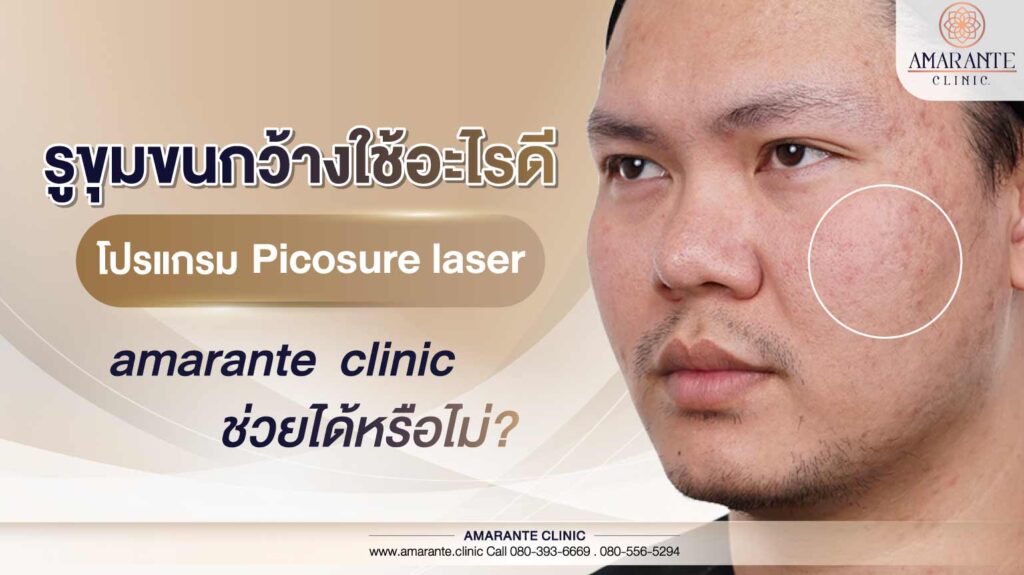 รูขมขนกว้าง ใช้อะไรดี Pico Laser ที่ Amarenteconsult ช่วยได้หรือไม่