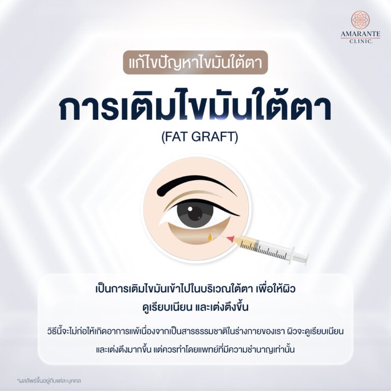 การเติมไขมันใต้ตา