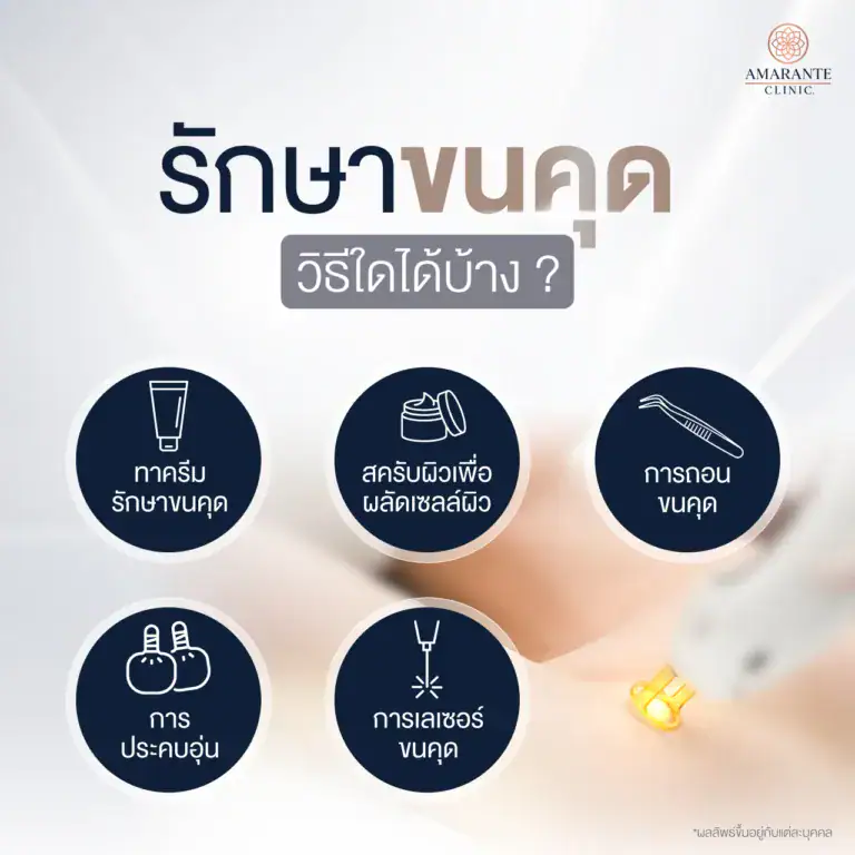 ขนคุดรักษาวิธีใดได้บ้าง