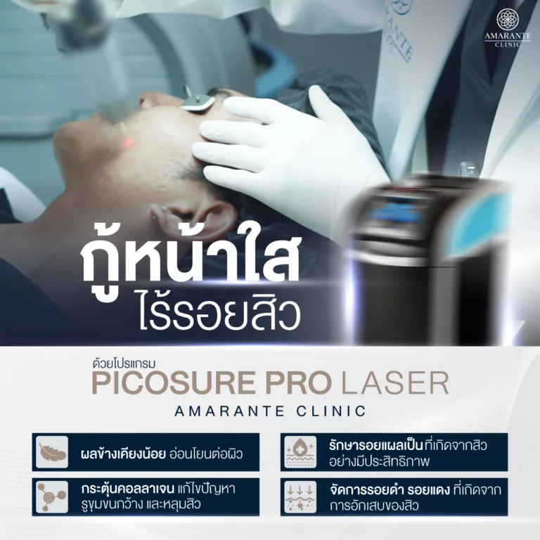 สิวหัวช้างรักษา