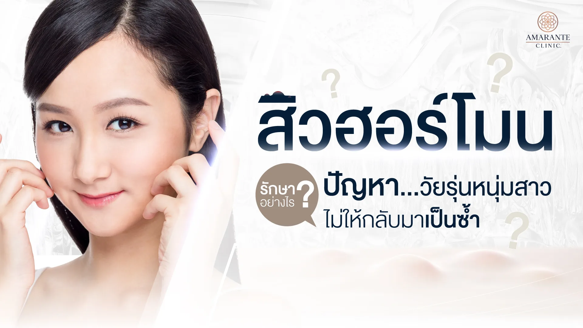 สิวฮอร์โมน