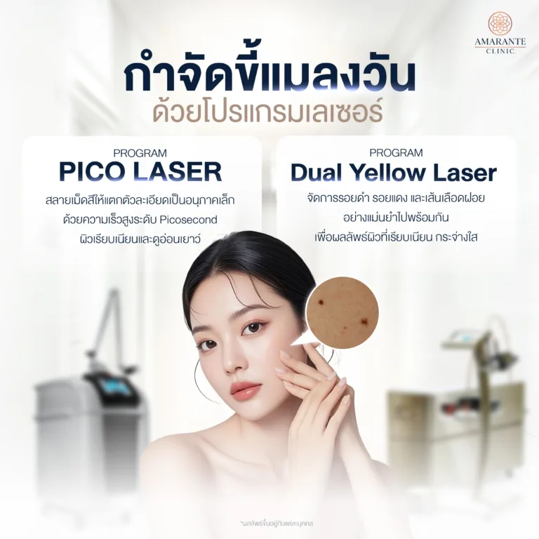 วิธีกำจัดขี้แมลงวัน ด้วยโปรแกรมเลเซอร์ ?