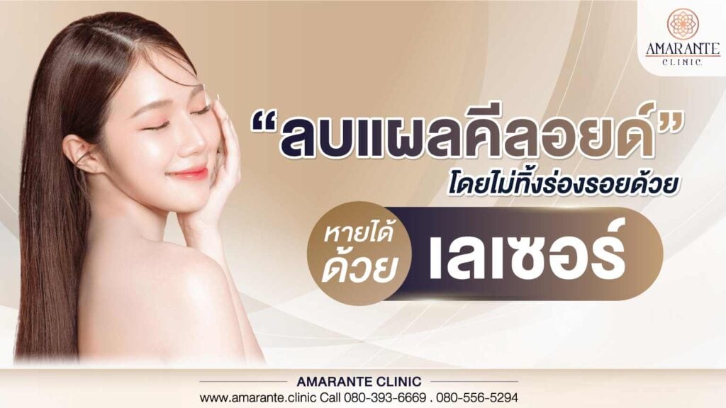ลบแผลคีลอยด์ โดยไม่ทิ้งร่องรอยด้วย หายได้ด้วยเลเซอร์