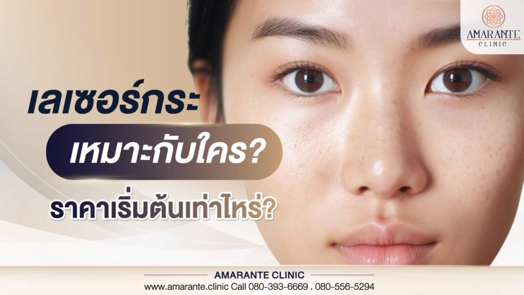 เลเซอร์กระ รักษาปัญหาใดได้บ้าง และราคาเริ่มต้นเท่าไหร่