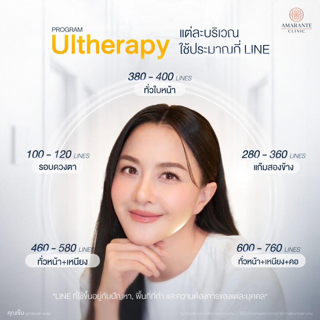 Ulthera ต้องทำทั่วหน้ากี่ช็อต?