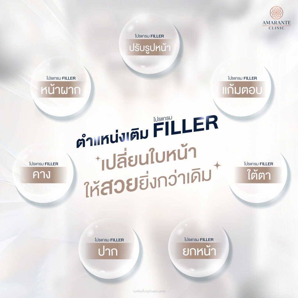 เทรนด์ฉีดฟิลเลอร์ ฉีดตำแหน่งไหนดี
