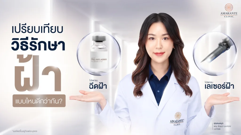 วิธีรักษาฝ้า ฉีดฝ้า vs เลเซอร์ฝ้า อันไหนดีกว่ากัน