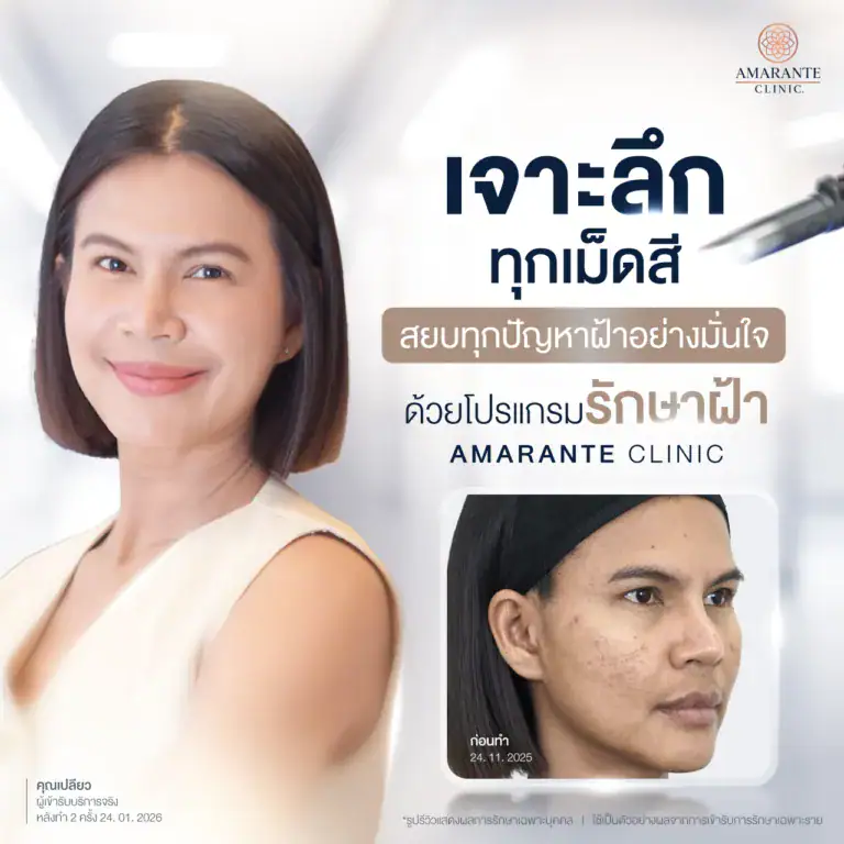 รีวิวโปรแกรมรักษาฝ้าจากลูกค้าที่รับบริการจริงที่ Amarante Clinic