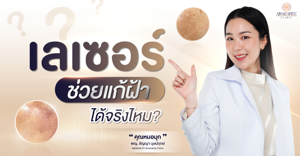 เลเซอร์ช่วยแก้ฝ้าได้จริงไหม