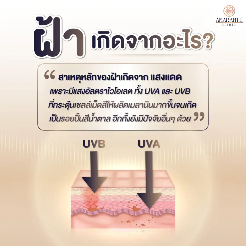 เลเซอร์ช่วยแก้ฝ้าได้จริงไหม -3