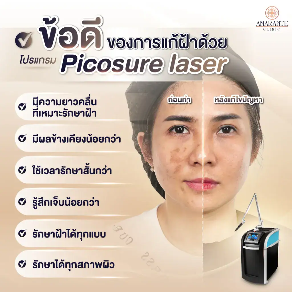 เลเซอร์ช่วยแก้ฝ้าได้จริงไหม -2