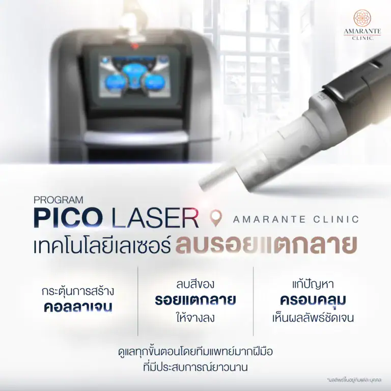 ข้อดีของการใช้ Pico Laser ในการแก้ปัญหารอยแตกลาย