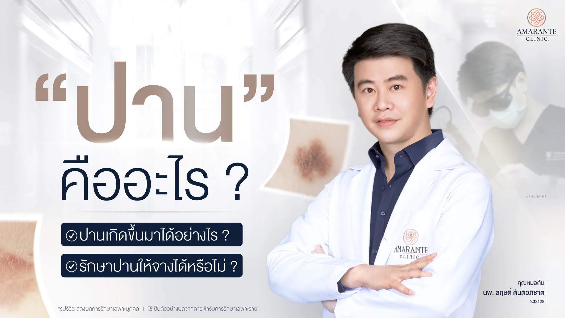 ปานคืออะไร เกิดขึ้นได้ยังไง วิธีการรักษา