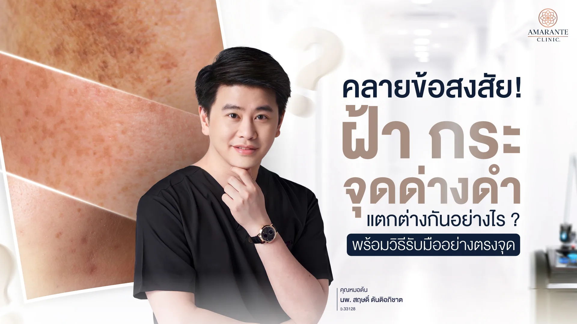 ฝ้า กระ จุดด่านดำต่างกันยังไง วิธีแก้ไข