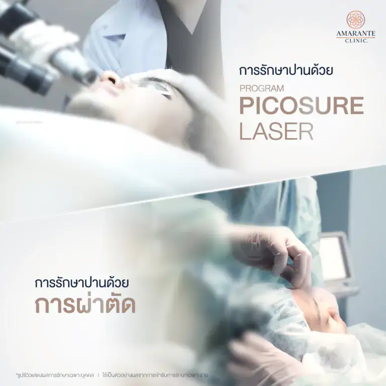 รักษาปานวิธีไหนได้บ้าง