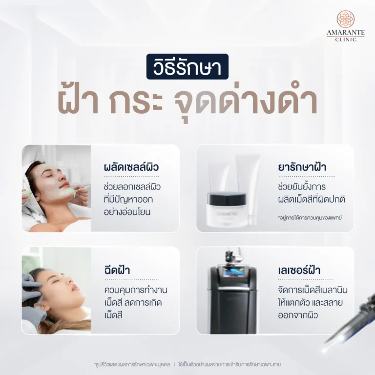 วิธีรักษาฝ้า กระ จุดด่างดำ