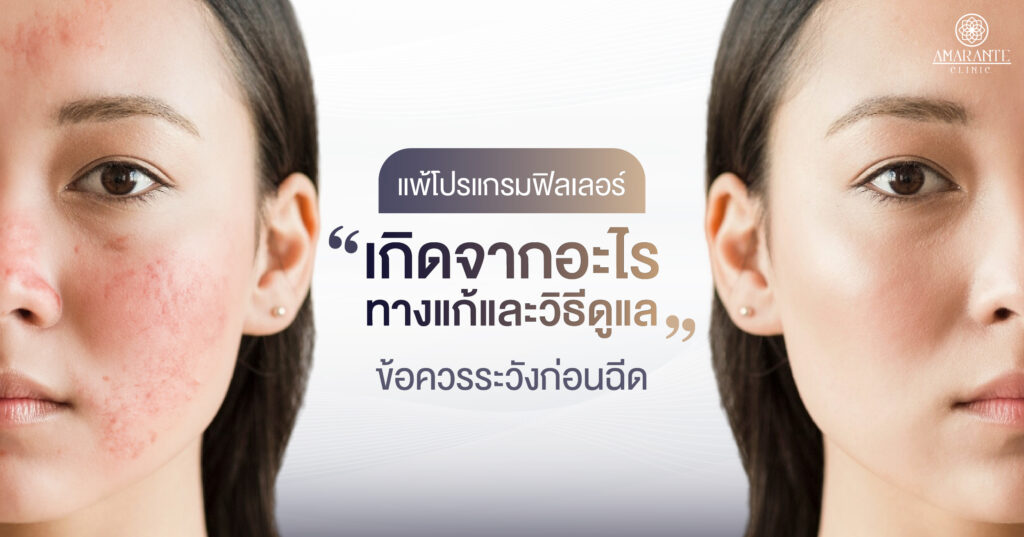 ปกภาพบความ-แพ้ฟิลเลอร์ เกิดจากอะไร ทางแก้และวิธีดูแล