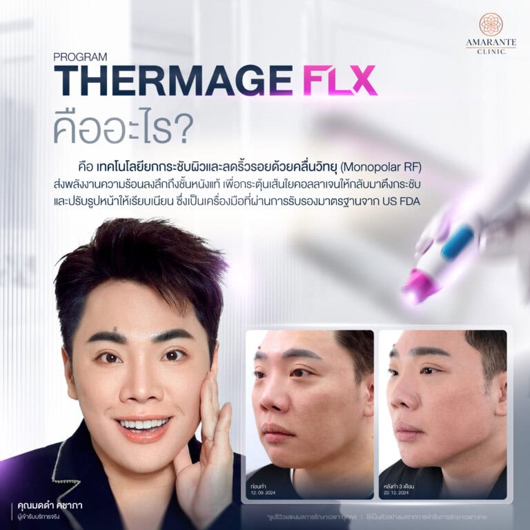 ยกระชับผิวหน้าด้วยโปรแกรม Thermage FLX