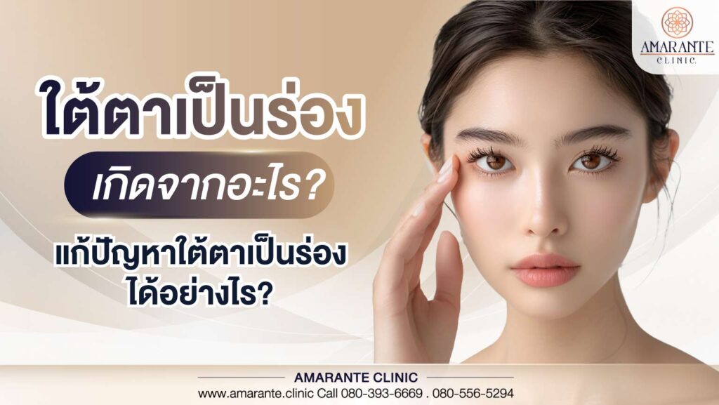 ใต้ตาเป็นร่องเกิดจากอะไร แก้ปัญหาใต้ตาเป็นร่องได้อย่างไรบ้าง
