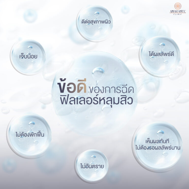 ข้อดีของการฉีดฟิลเลอร์หลุมสิว