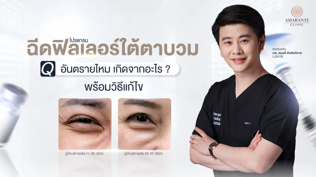 ฟิลเลอร์ใต้ตาบวม