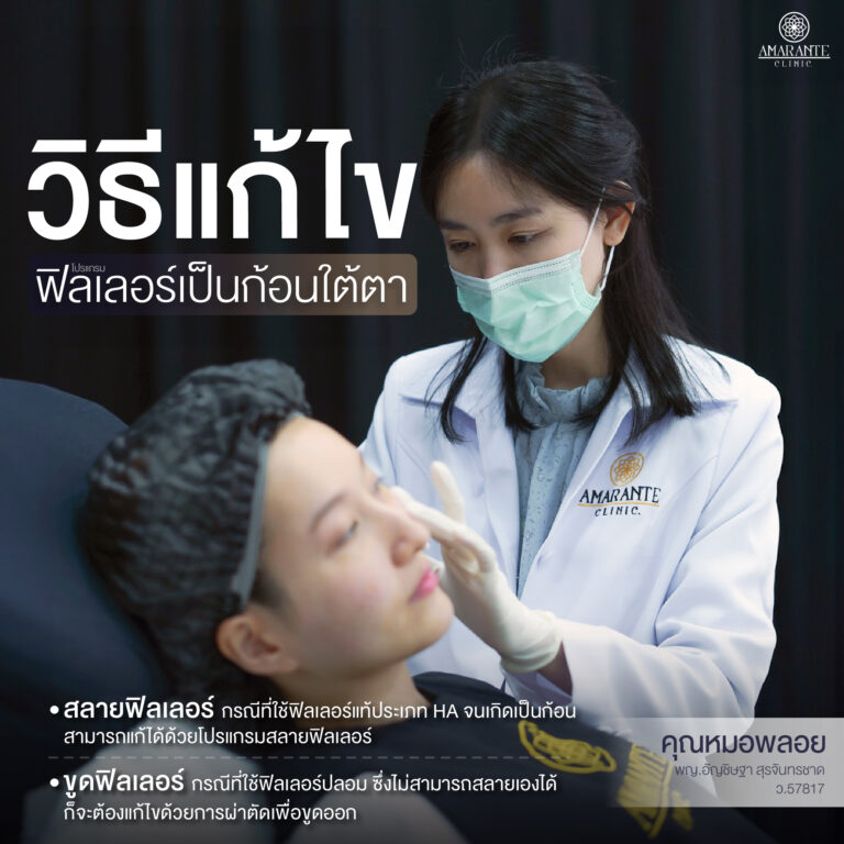 ภาพ infographic อธิบาย วิธีแก้ไขฟิลเลอร์เป็นก้อนใต้ตา