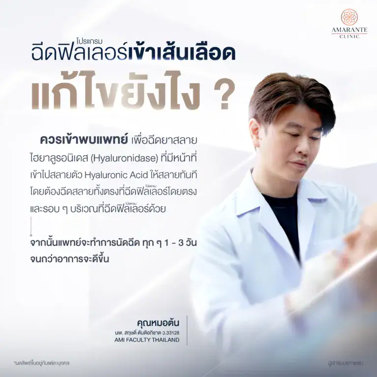 ฉีดฟิลเลอร์เข้าเส้นเลือดแก้ไขยังไง