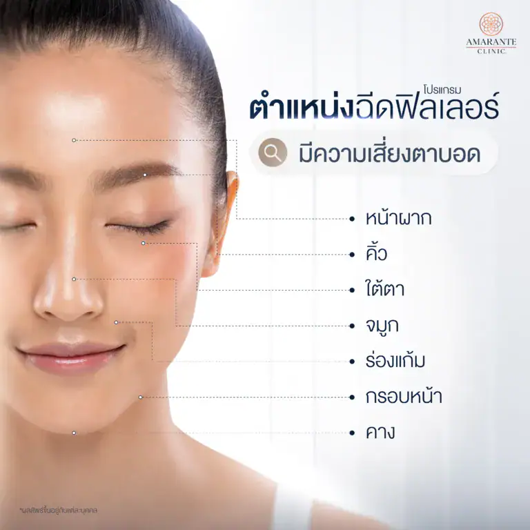 ตำแหน่งฉีดฟิลเลอร์มีความเสี่ยงตาบอด