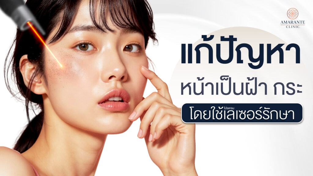 ปกภาพของบทความ - แก้ปัญหาหน้าเป็นฝ้า กระ โดยใช้เลเซอร์รักษา