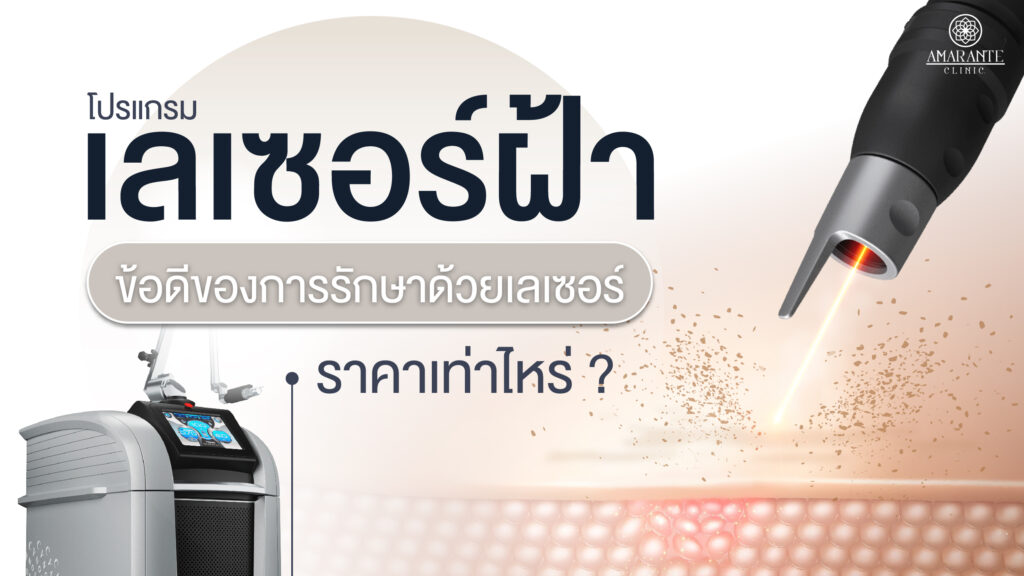 ปกหน้า เลเซอร์ฝ้า ข้อดีของการรักษาด้วยเลเซอร์ ราคาเท่าไหร่