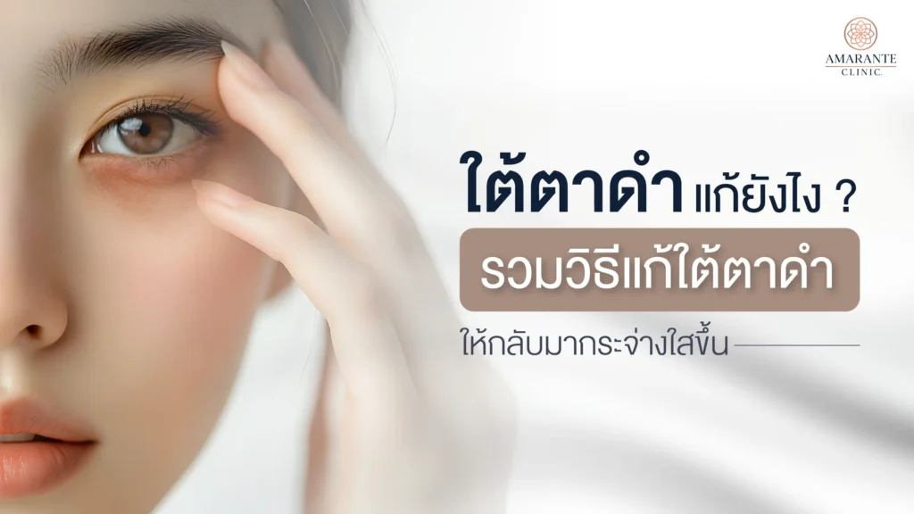 ภาพปก ใต้ตาดำแก้ยังไง? รวมเทคนิคและวิธีแก้ใต้ตาดำให้กลับมากระจ่างใสขึ้น