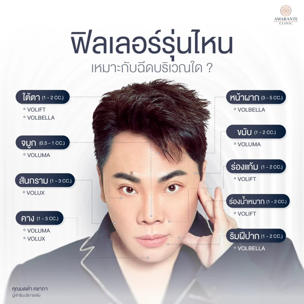 ภาพ infographic อธิบาย Juvederm เหมาะกับฉีดบริเวณใด?