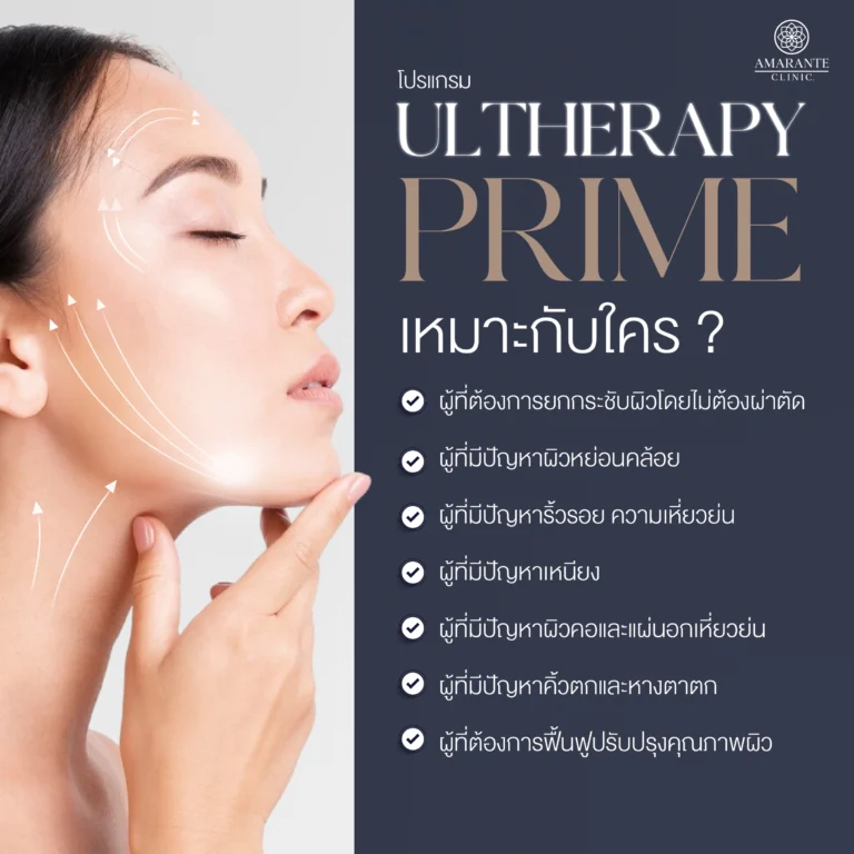 Ulthera Prime เหมาะกับใคร