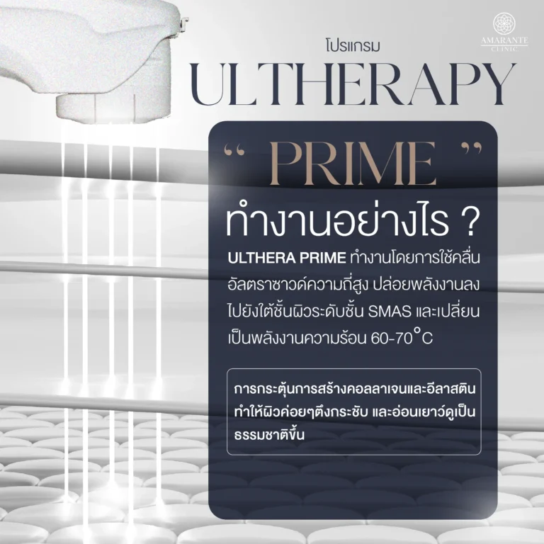 Ulthera Prime ทำงานอย่างไร