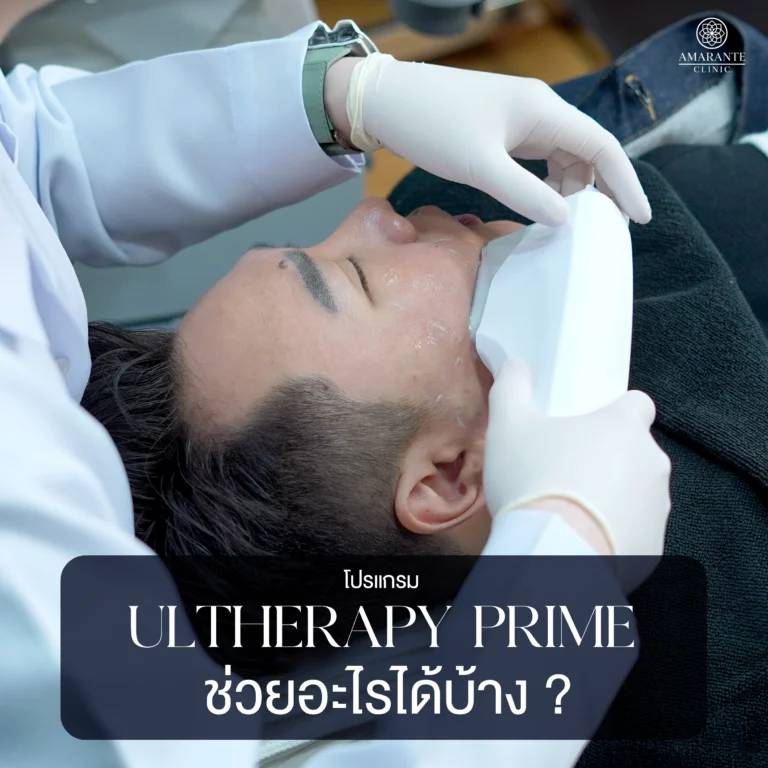 Ulthera Prime ช่วยอะไรได้บ้าง