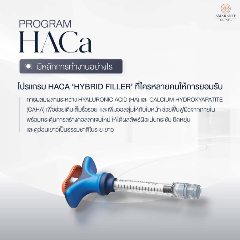 HArmonyCa ทำงานอย่างไร?