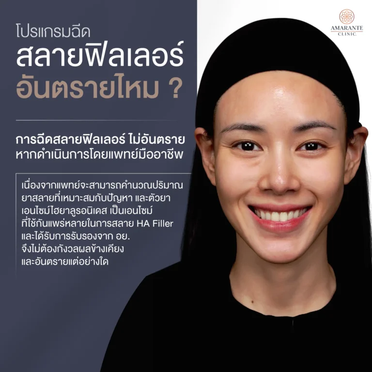 ฉีดสลายฟิลเลอร์อันตรายไหม?